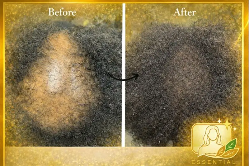 Esthetician Portfolio Photo