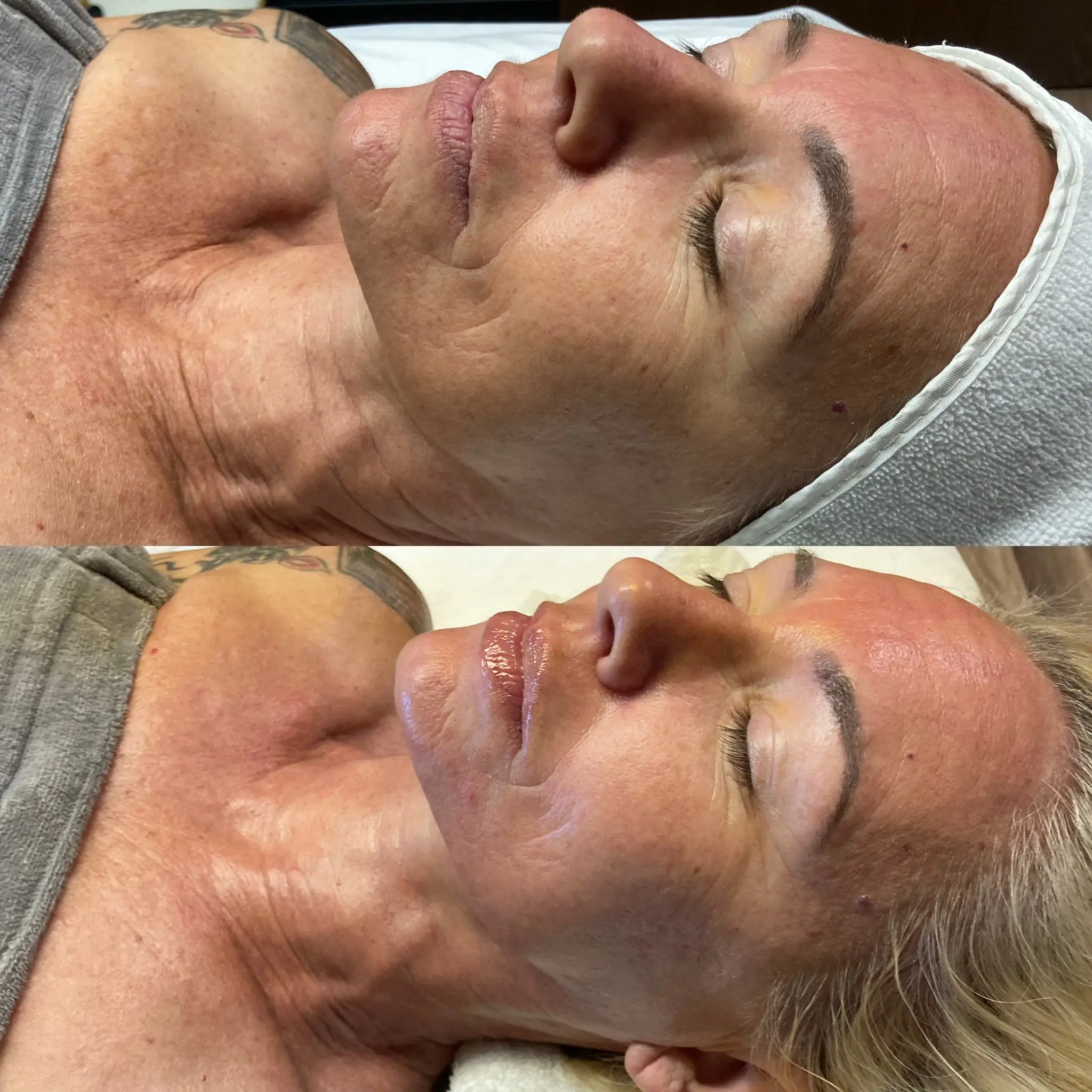 Esthetician Portfolio Photo