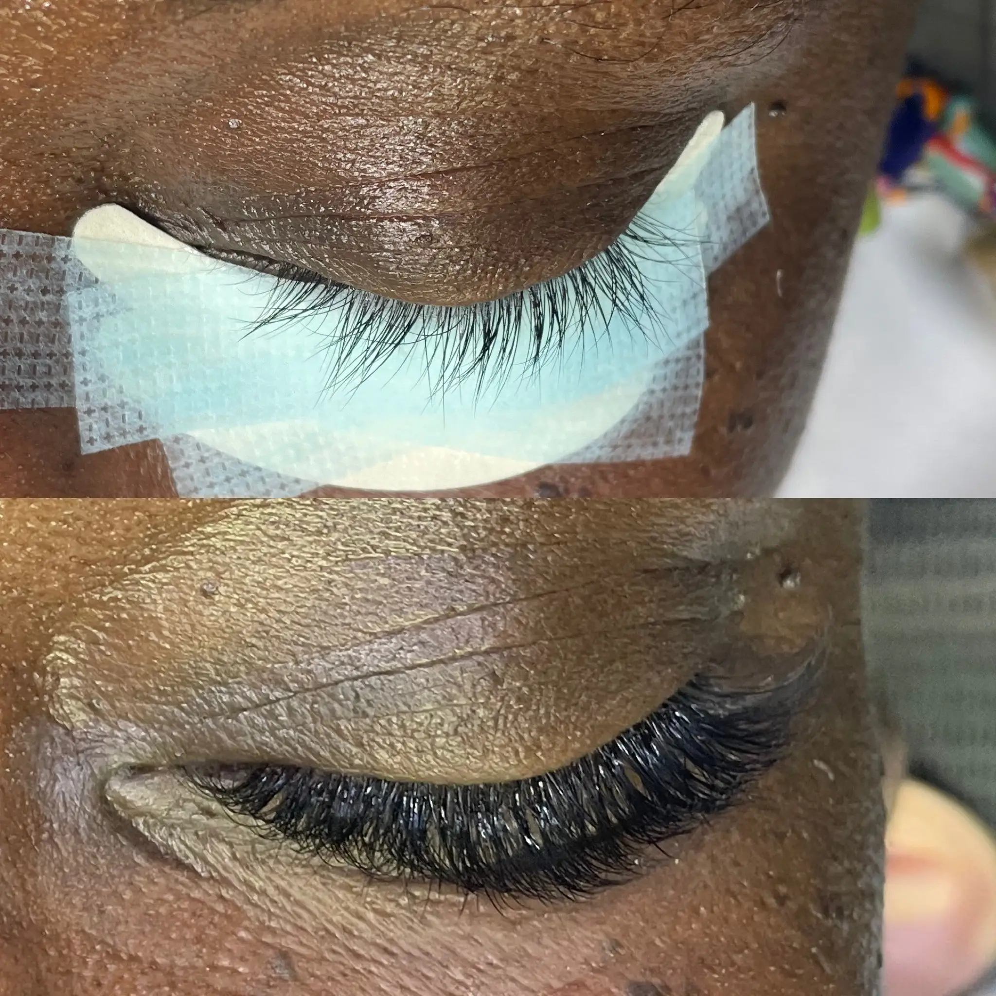 Esthetician Portfolio Photo