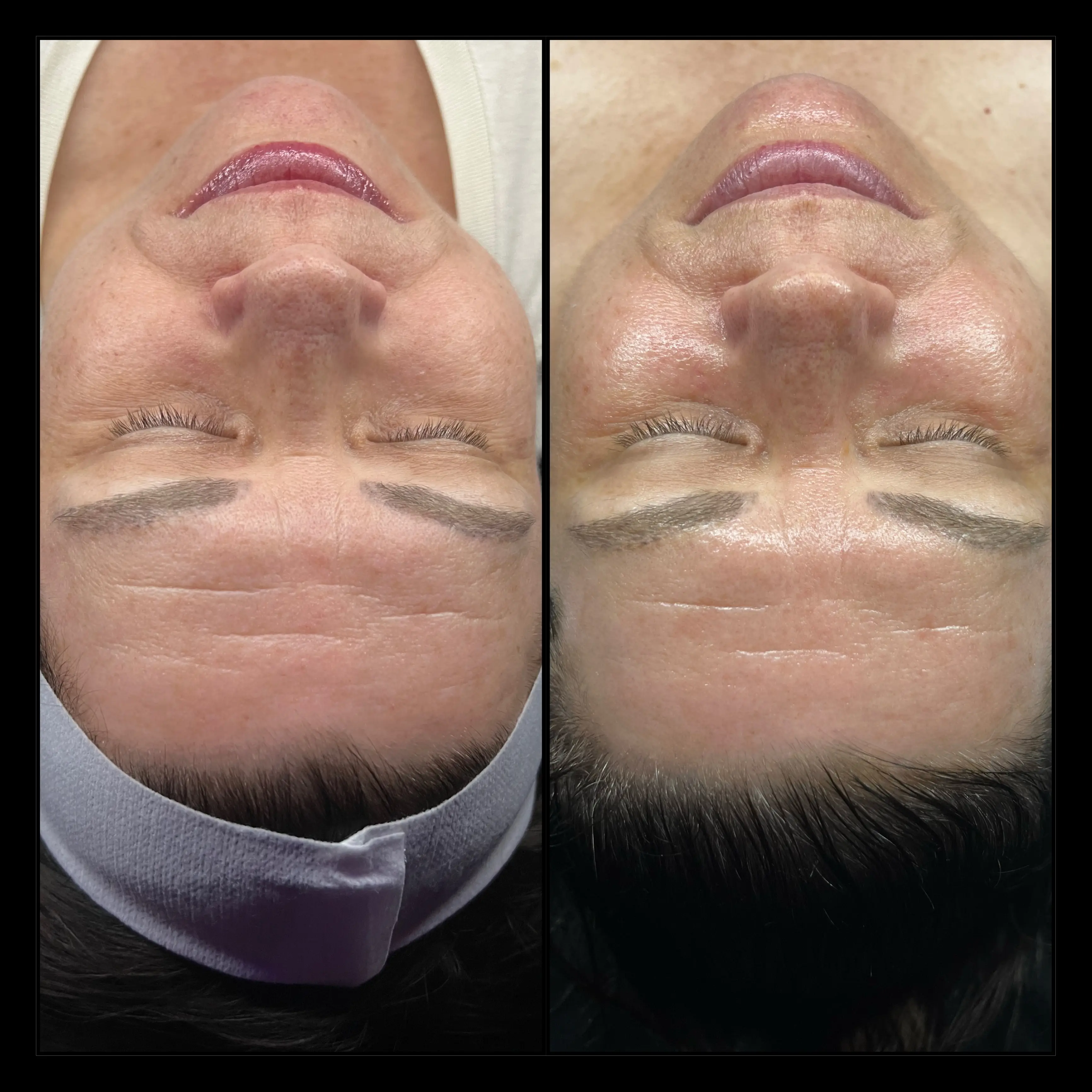 Work by Amethyst Skin Clinic