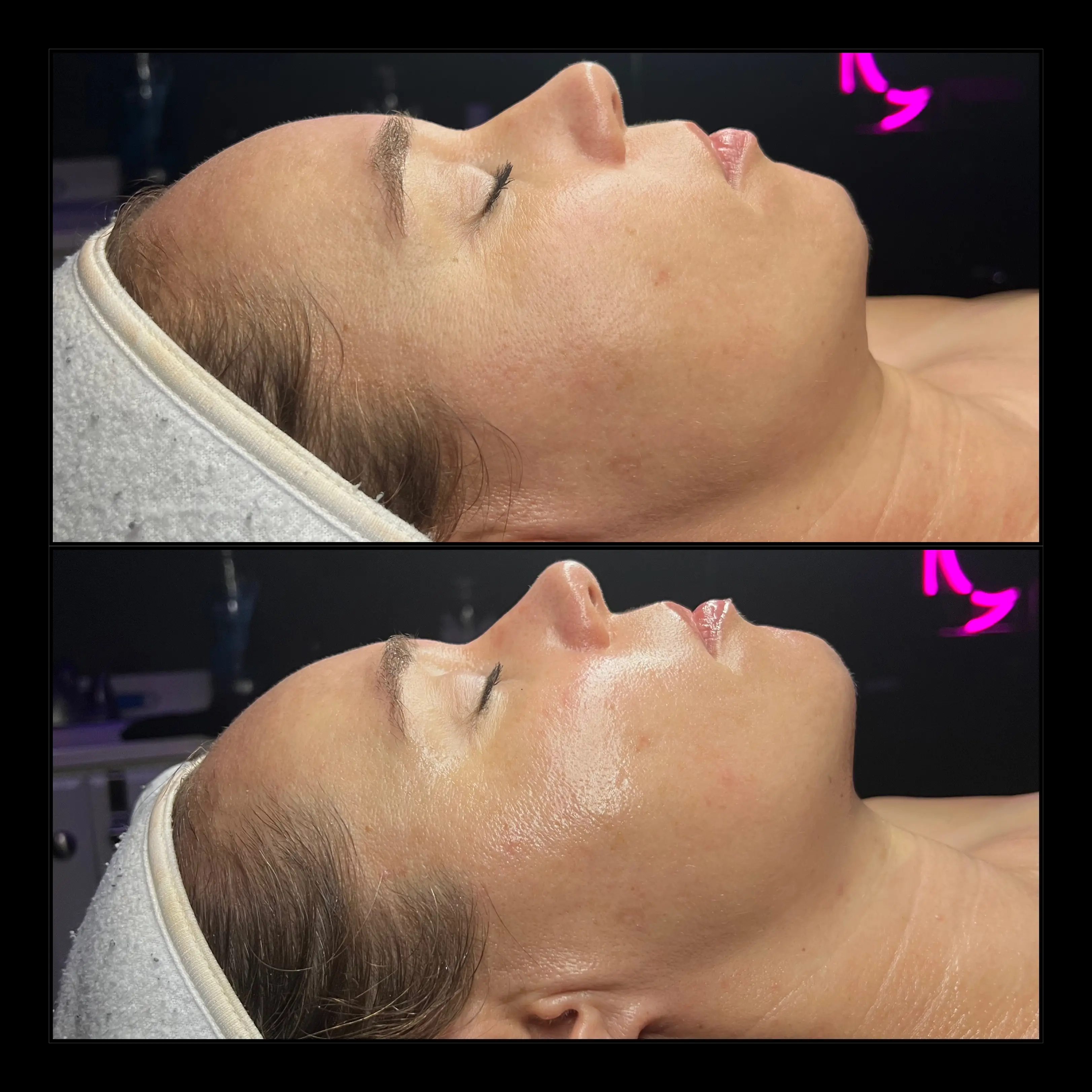 Work by Amethyst Skin Clinic