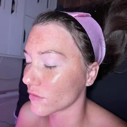 Esthetician Portfolio Photo