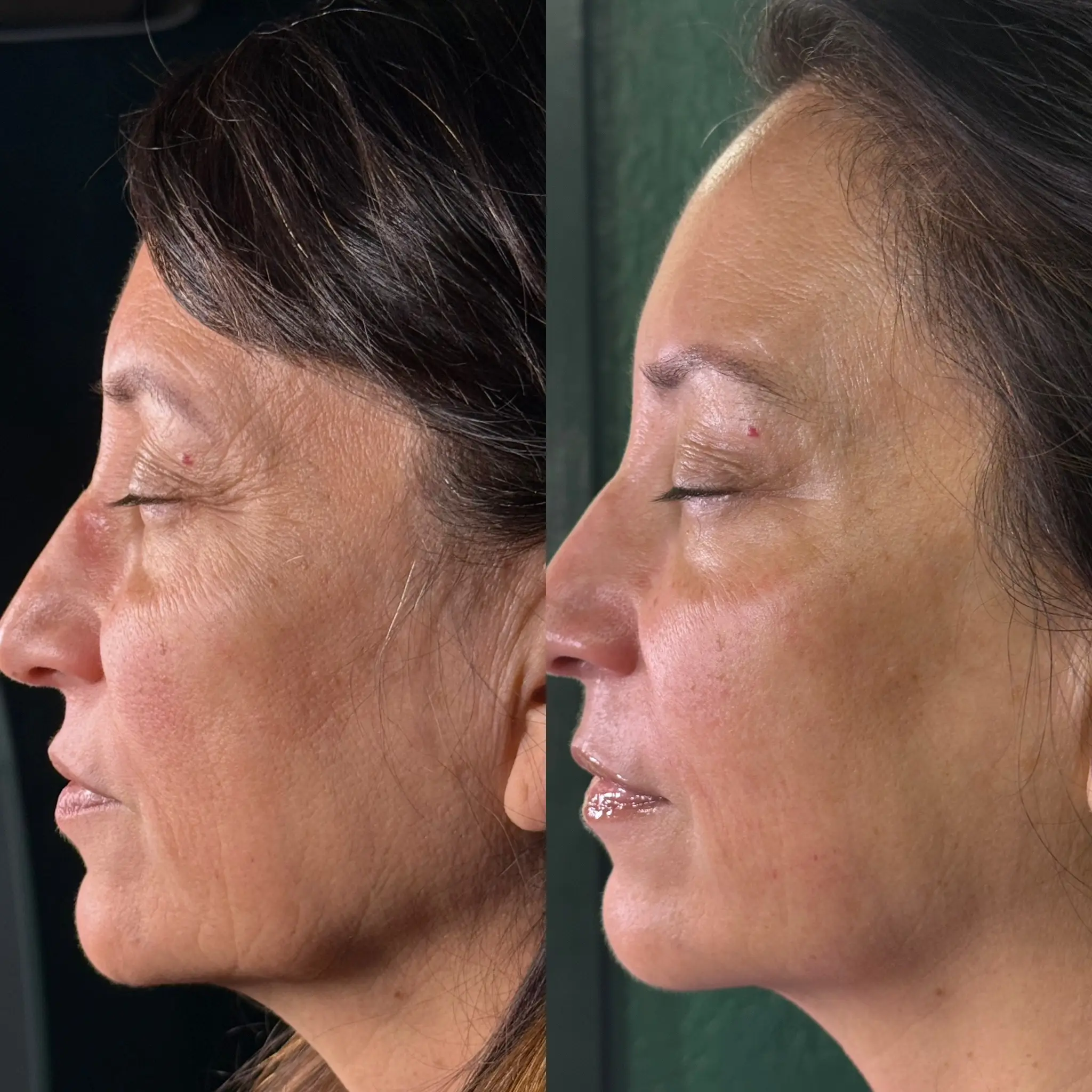 Esthetician Portfolio Photo