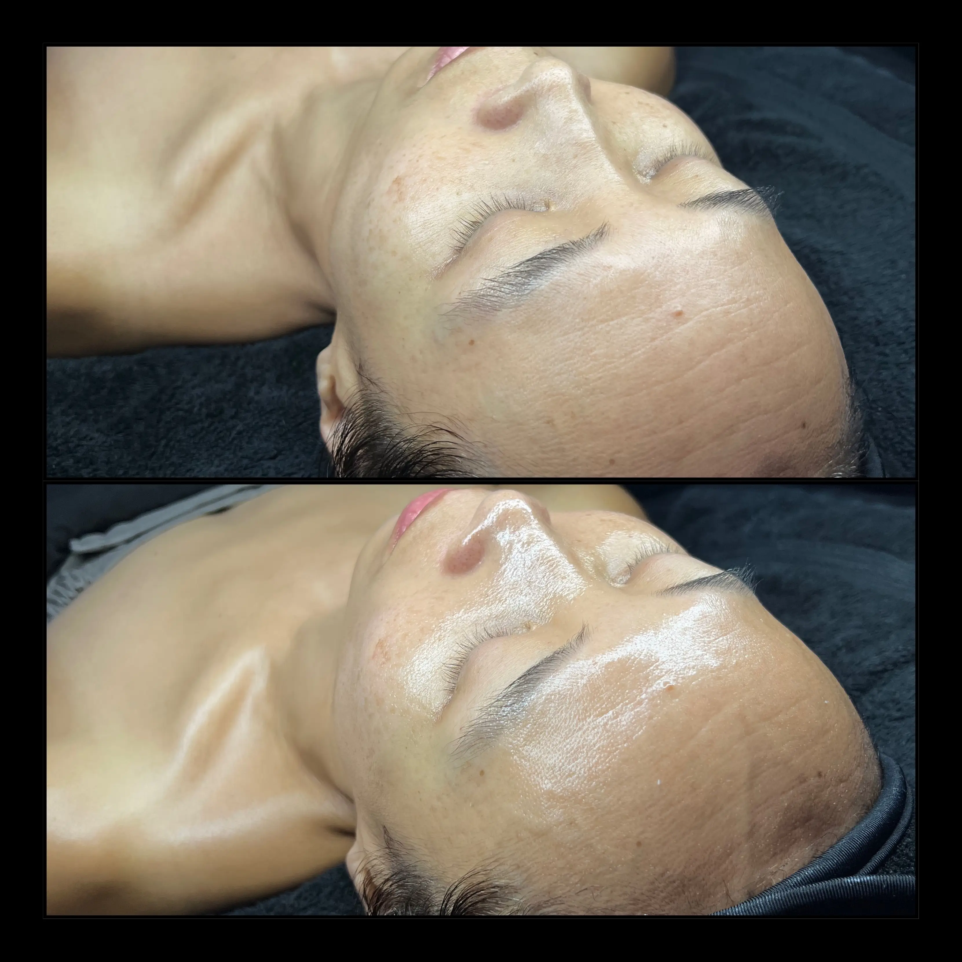 Work by Amethyst Skin Clinic