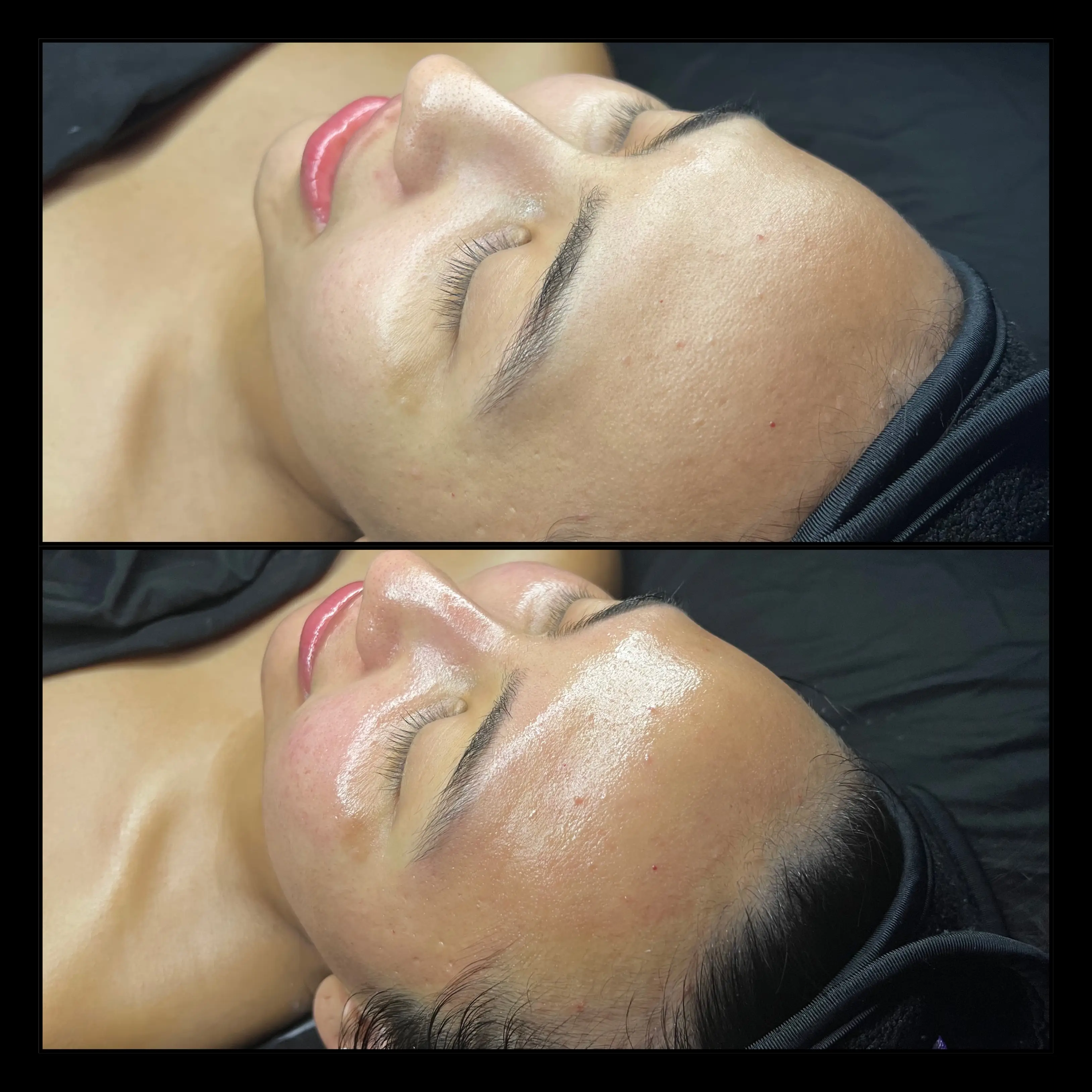 Work by Amethyst Skin Clinic
