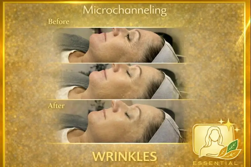 Esthetician Portfolio Photo