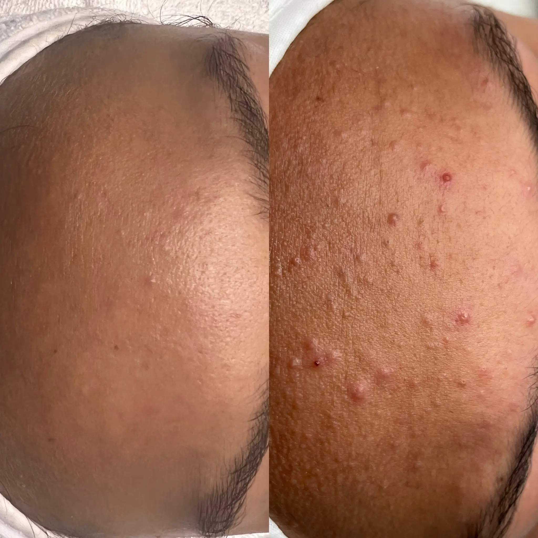 Esthetician Portfolio Photo