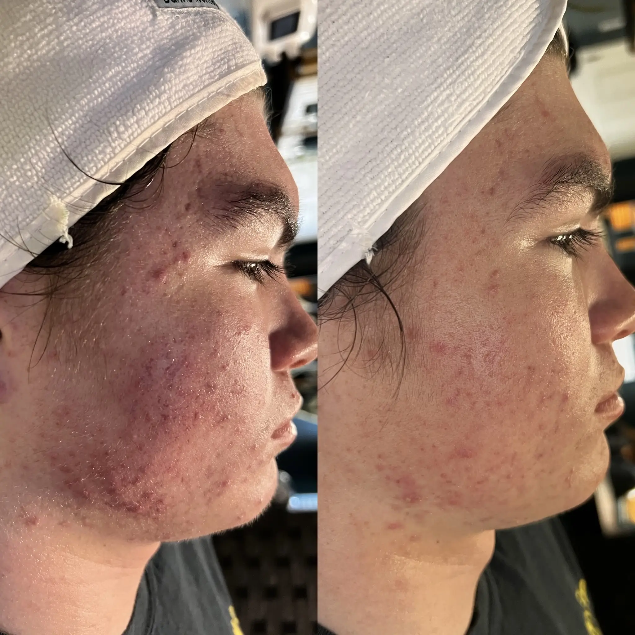 Esthetician Portfolio Photo