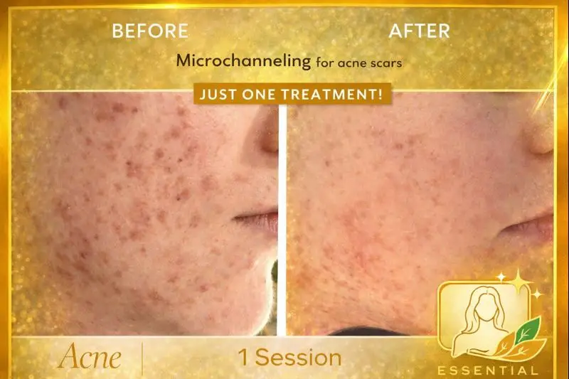 Esthetician Portfolio Photo