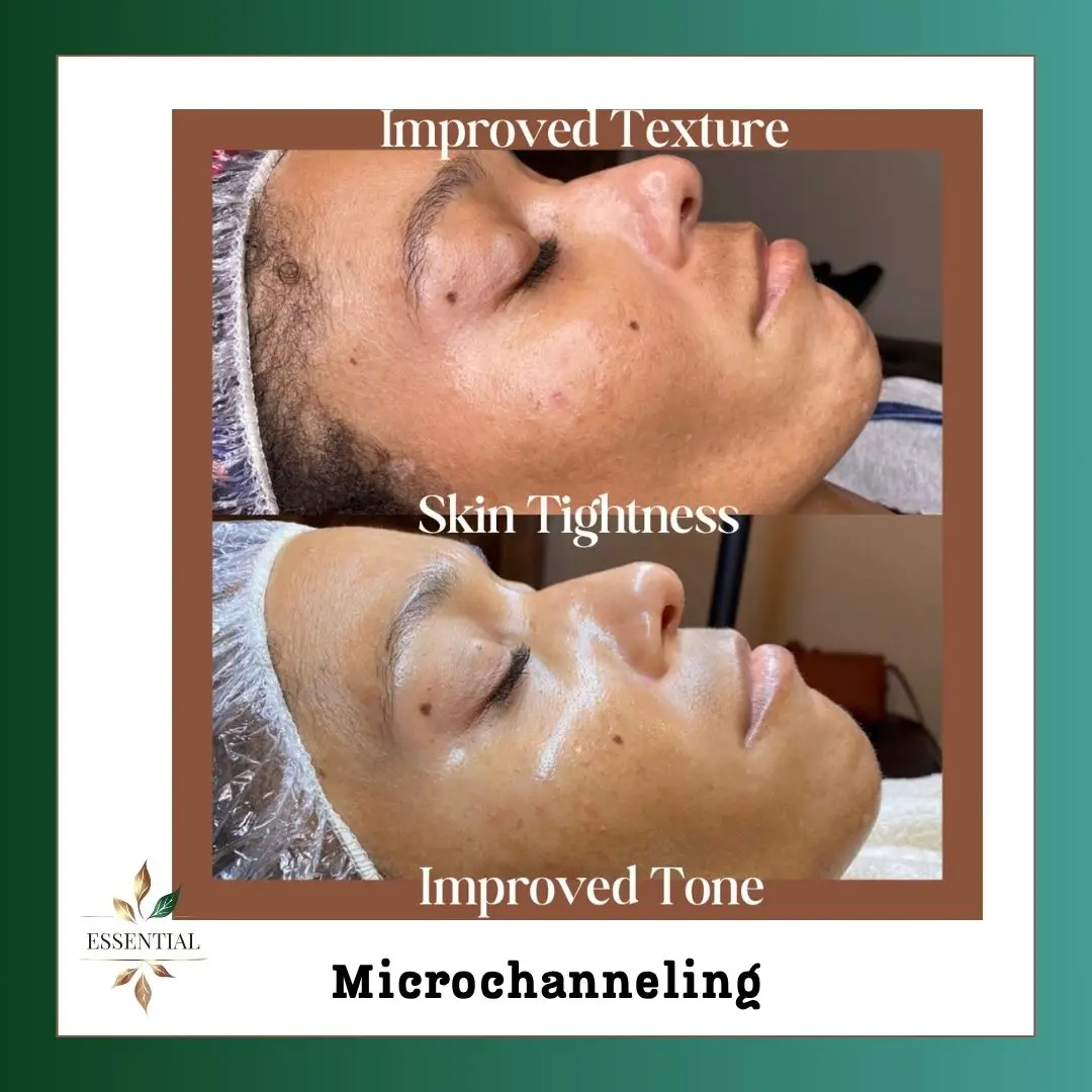Esthetician Portfolio Photo