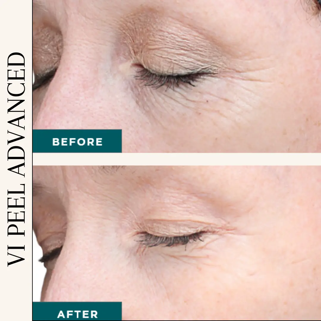 Esthetician Portfolio Photo