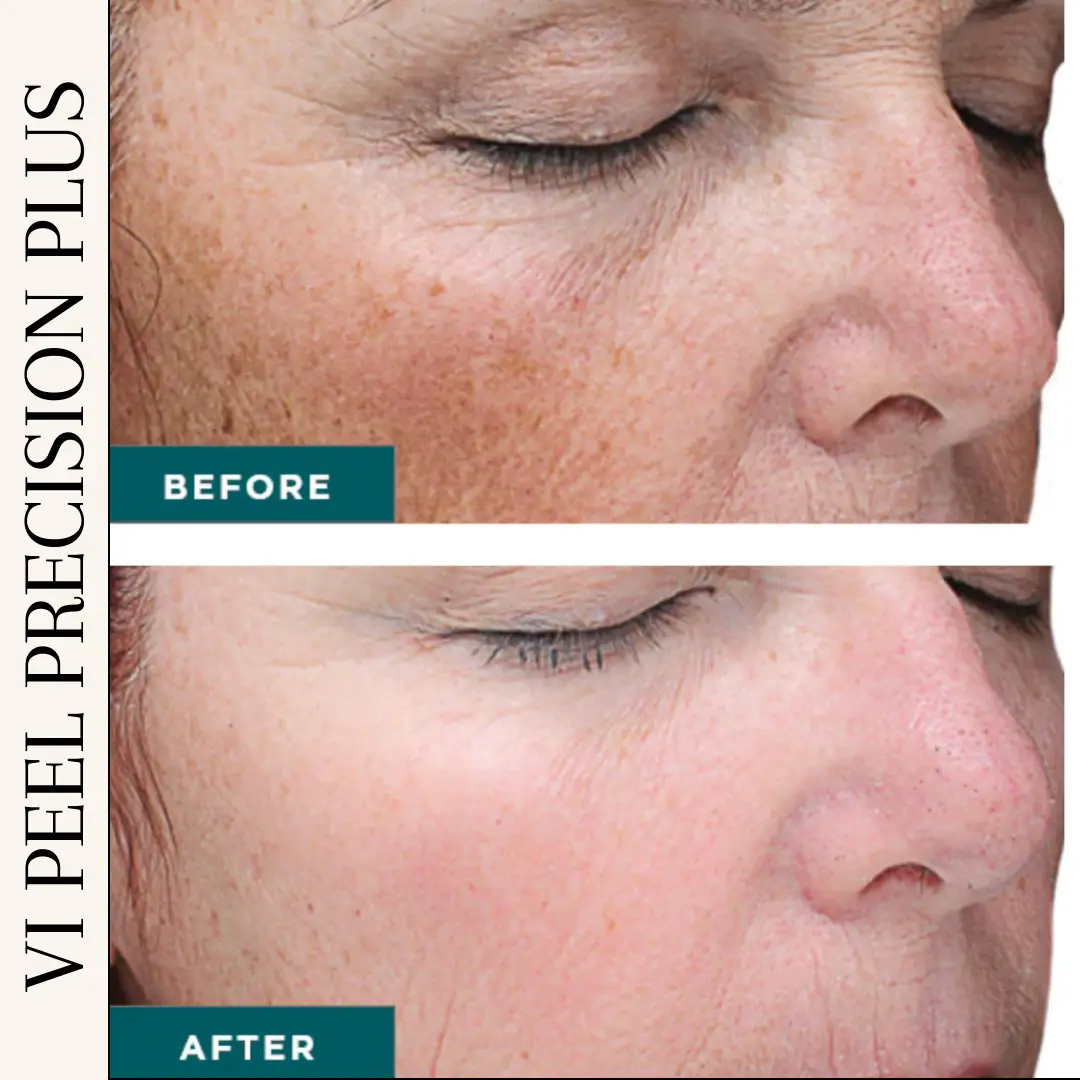 Esthetician Portfolio Photo