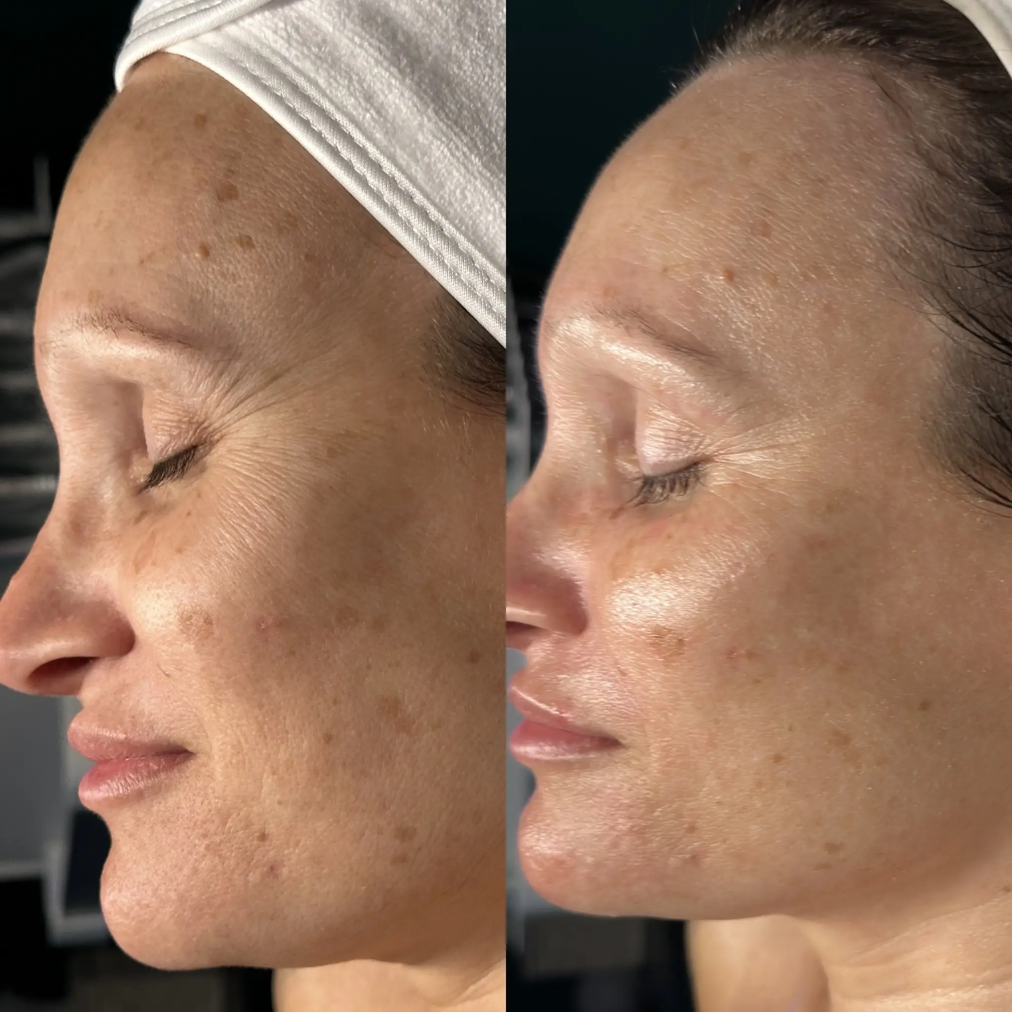 Esthetician Portfolio Photo