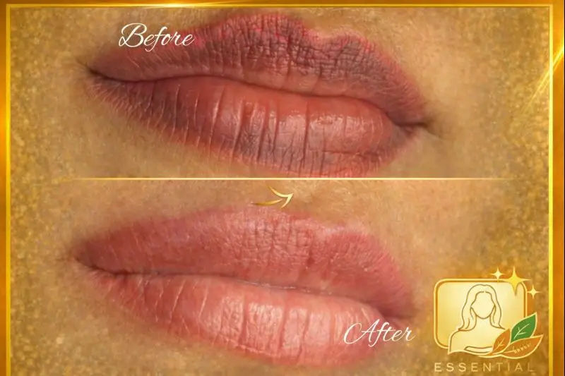 Esthetician Portfolio Photo