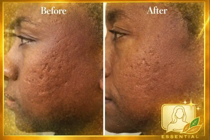 Esthetician Portfolio Photo