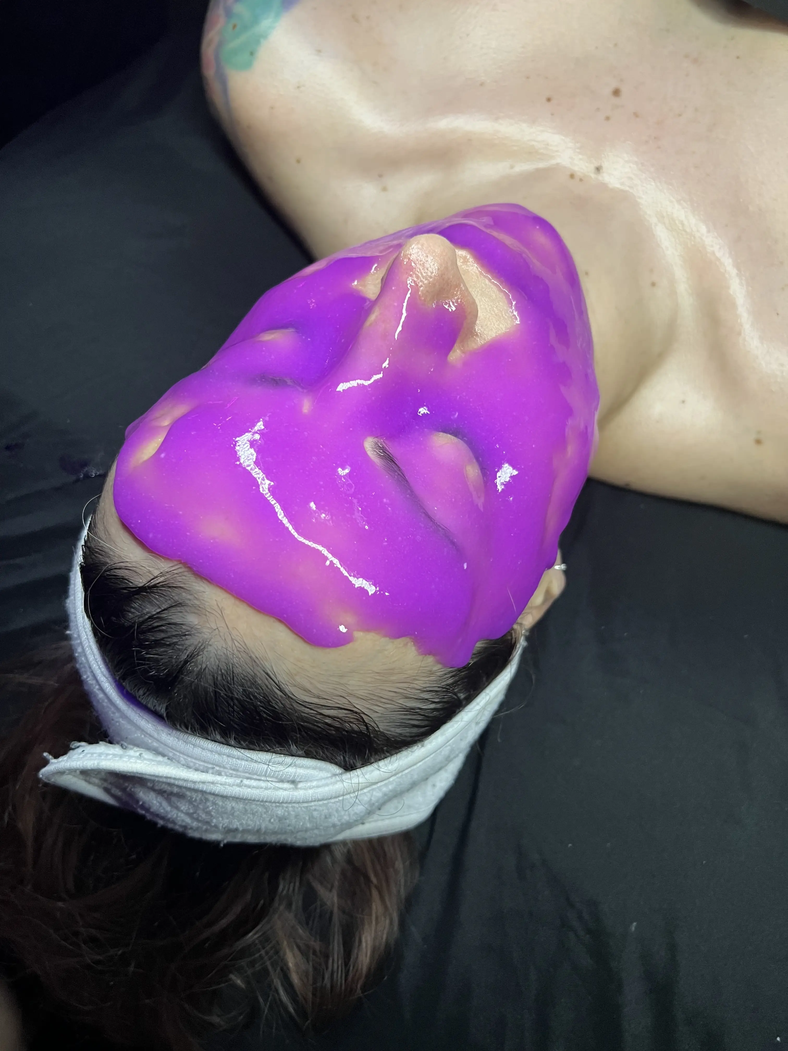Work by Amethyst Skin Clinic
