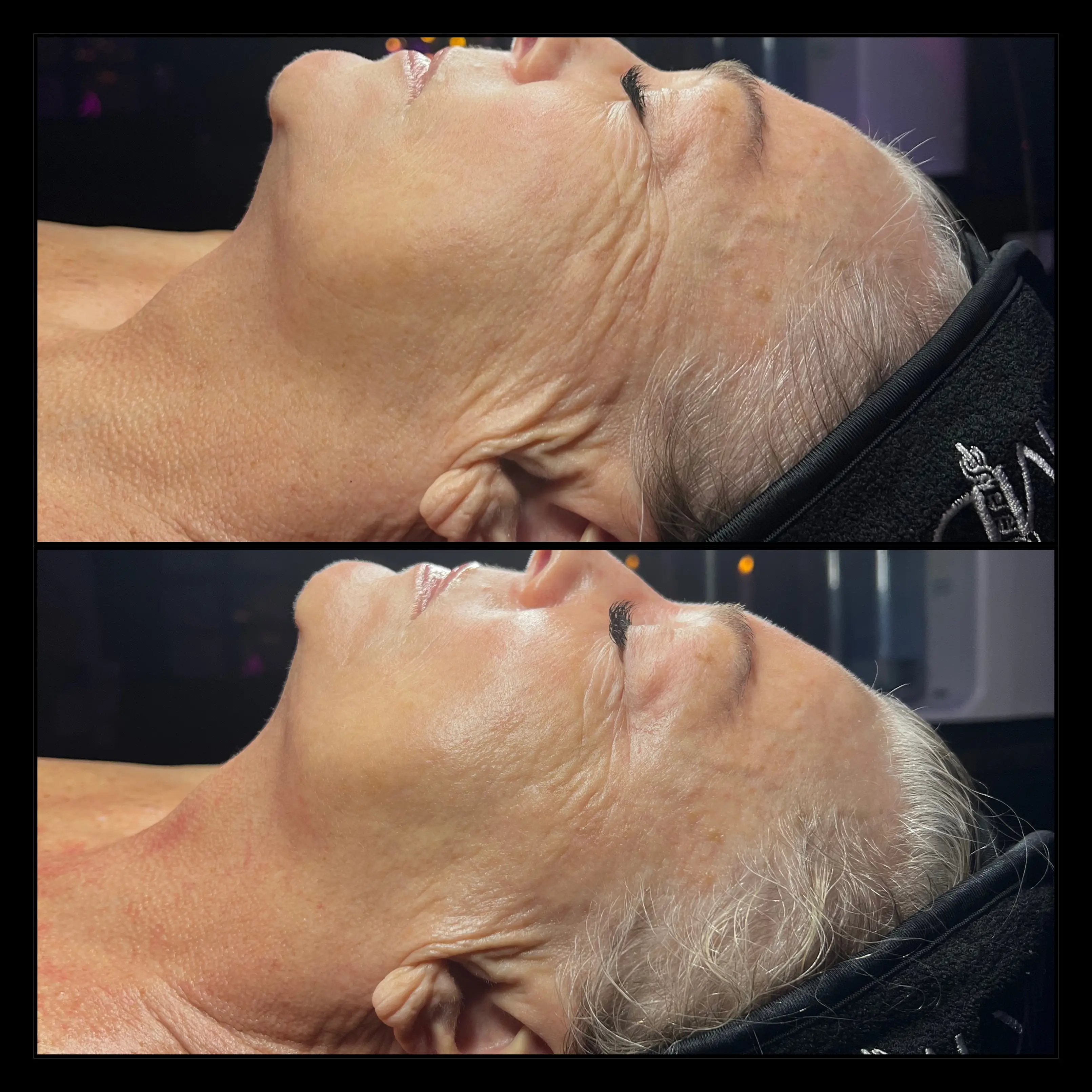 Work by Amethyst Skin Clinic