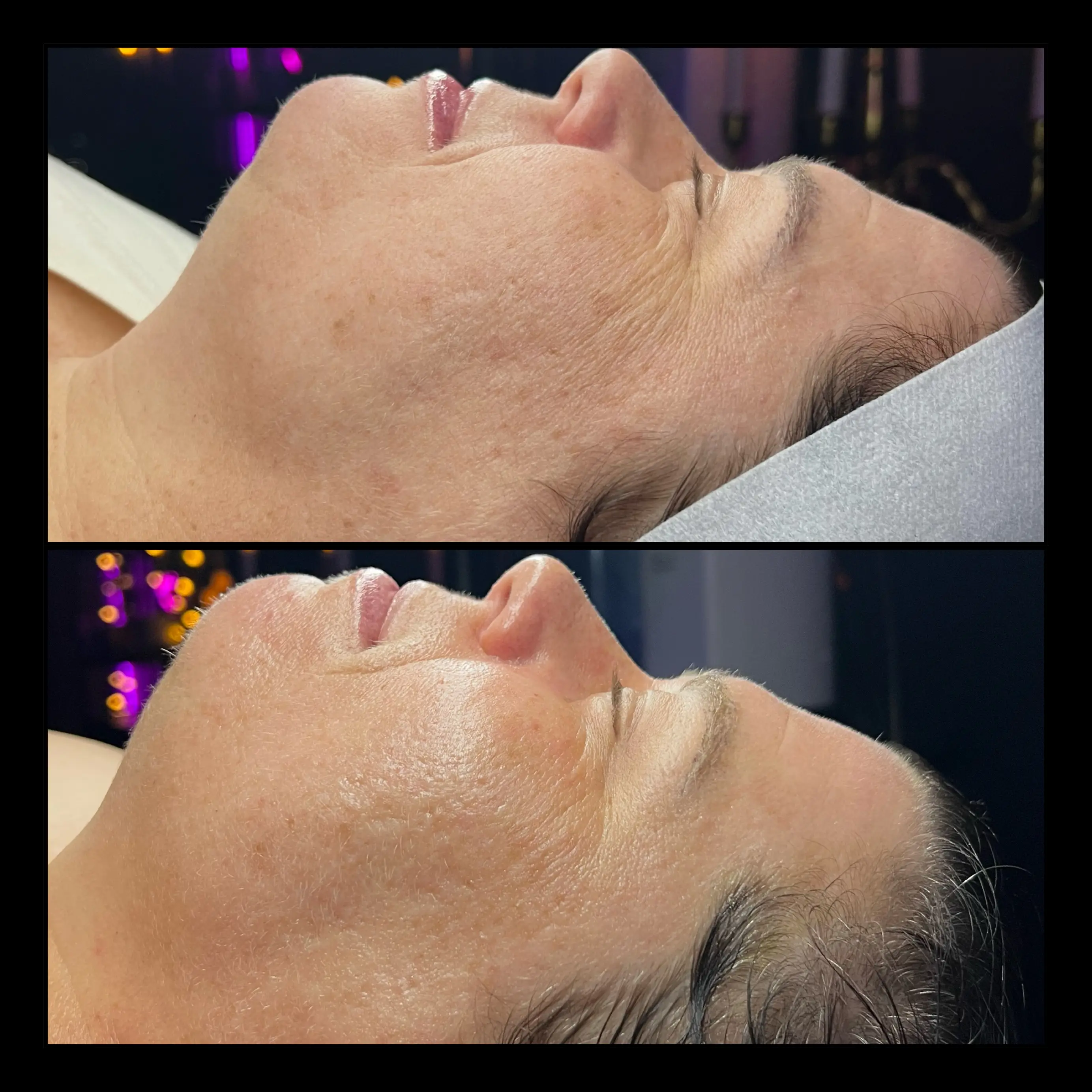 Work by Amethyst Skin Clinic