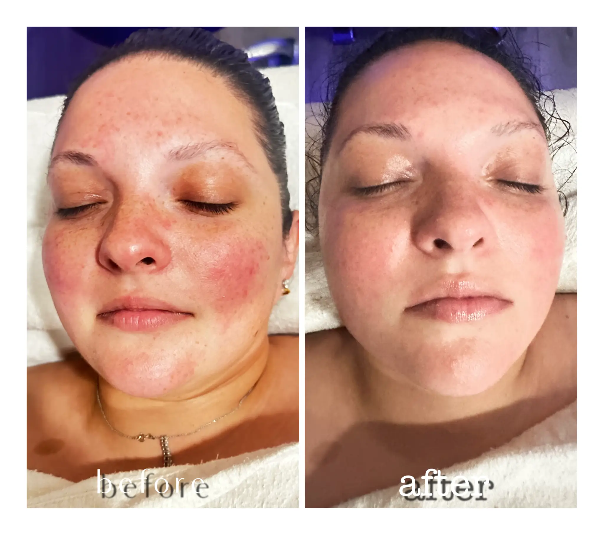 Waxing Specialist Portfolio Photo