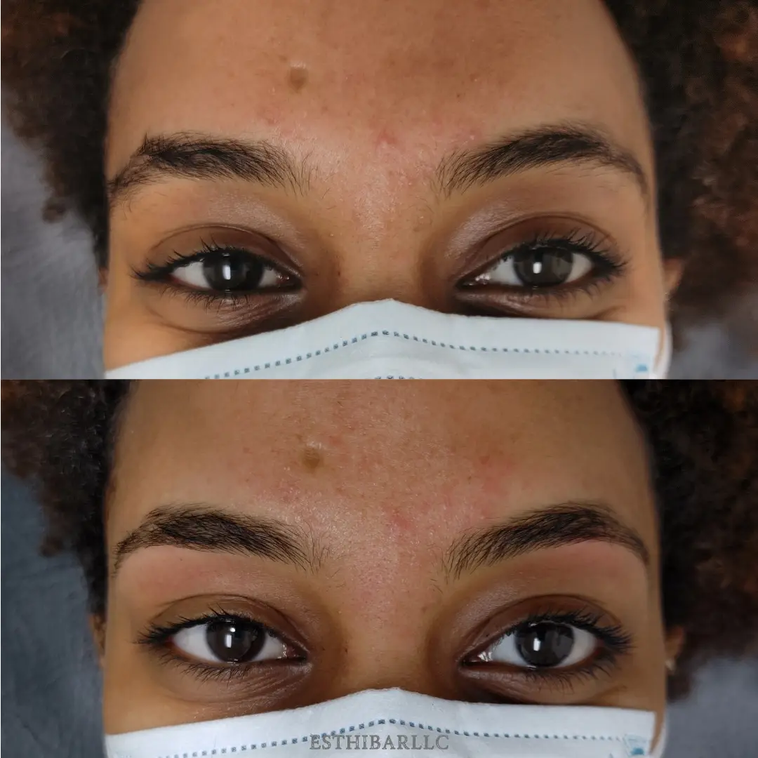 Esthetician Portfolio Photo