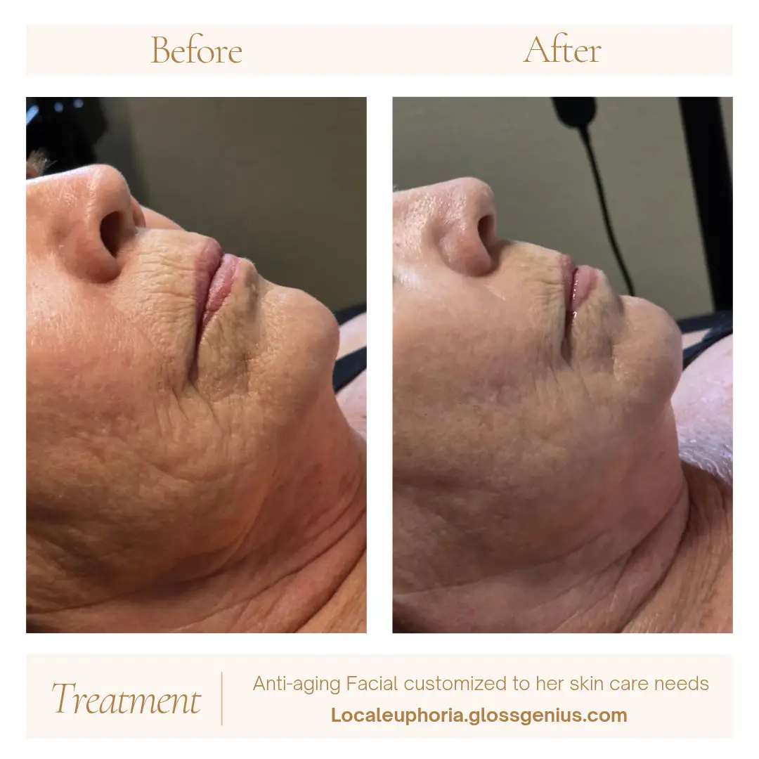 Esthetician Portfolio Photo