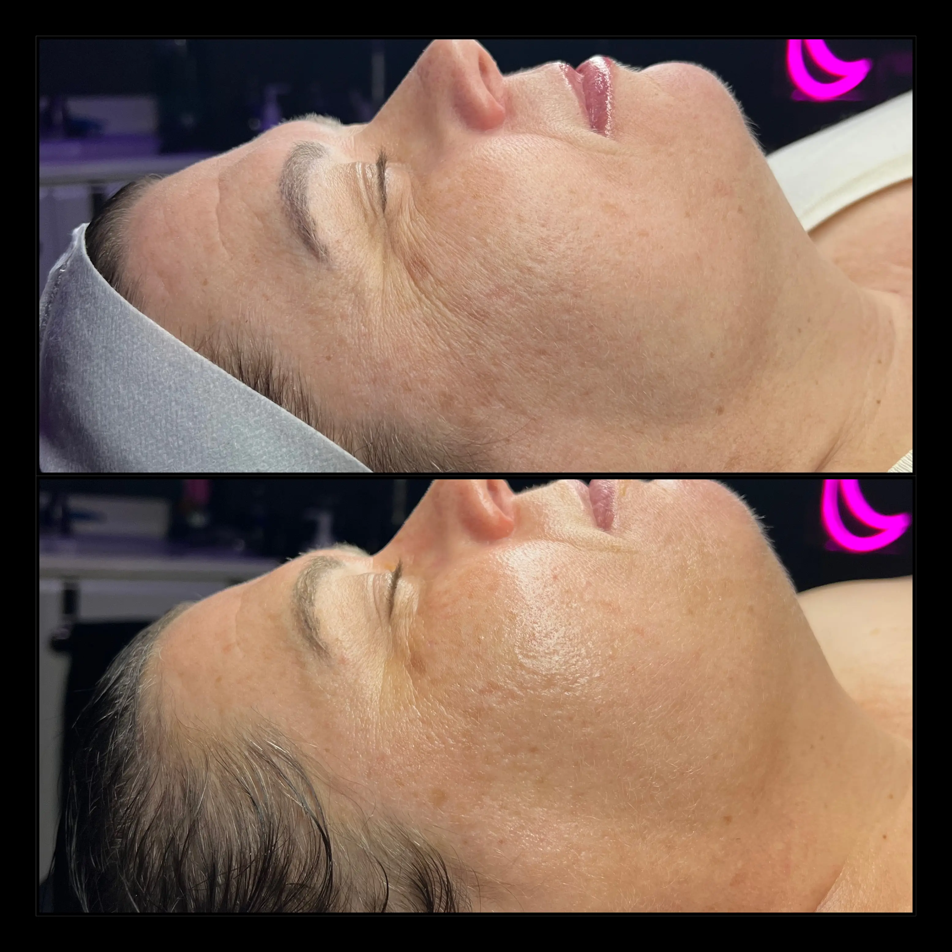 Work by Amethyst Skin Clinic