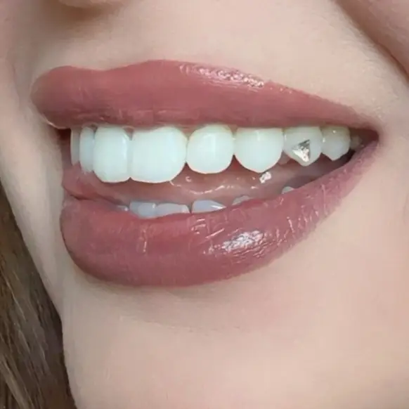 Work by Dollhouse Esthetics