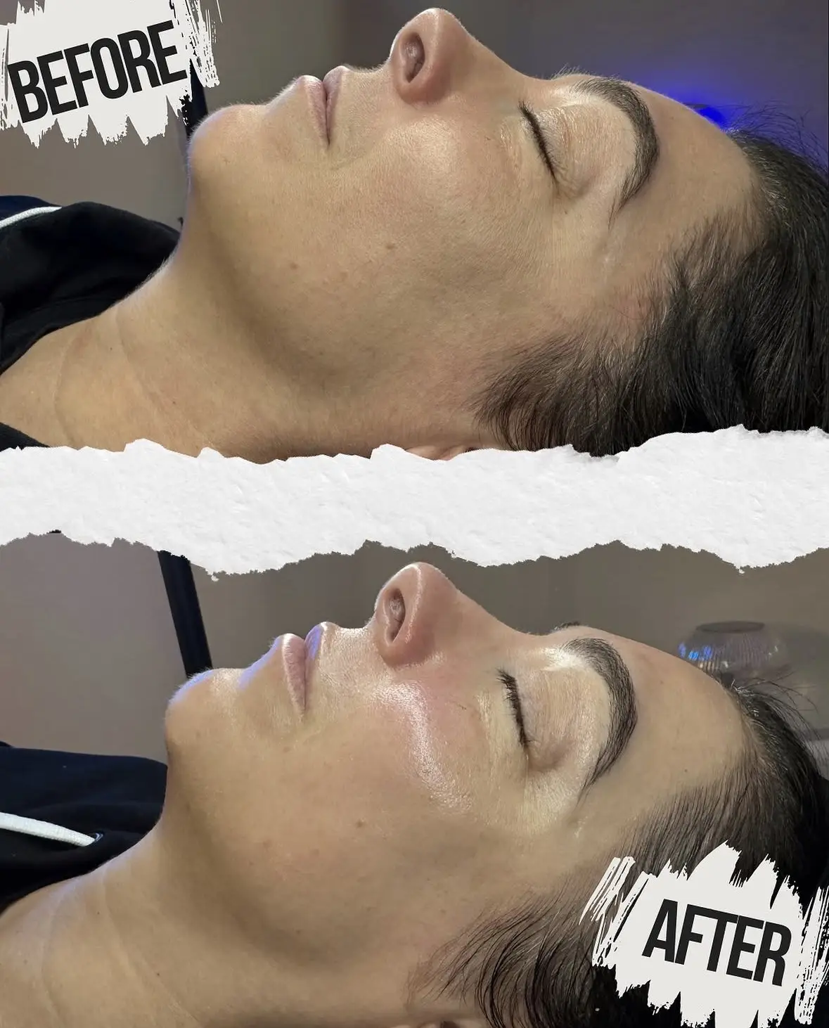 Deluxe K-Beauty Treatment + Dermaplane Facial