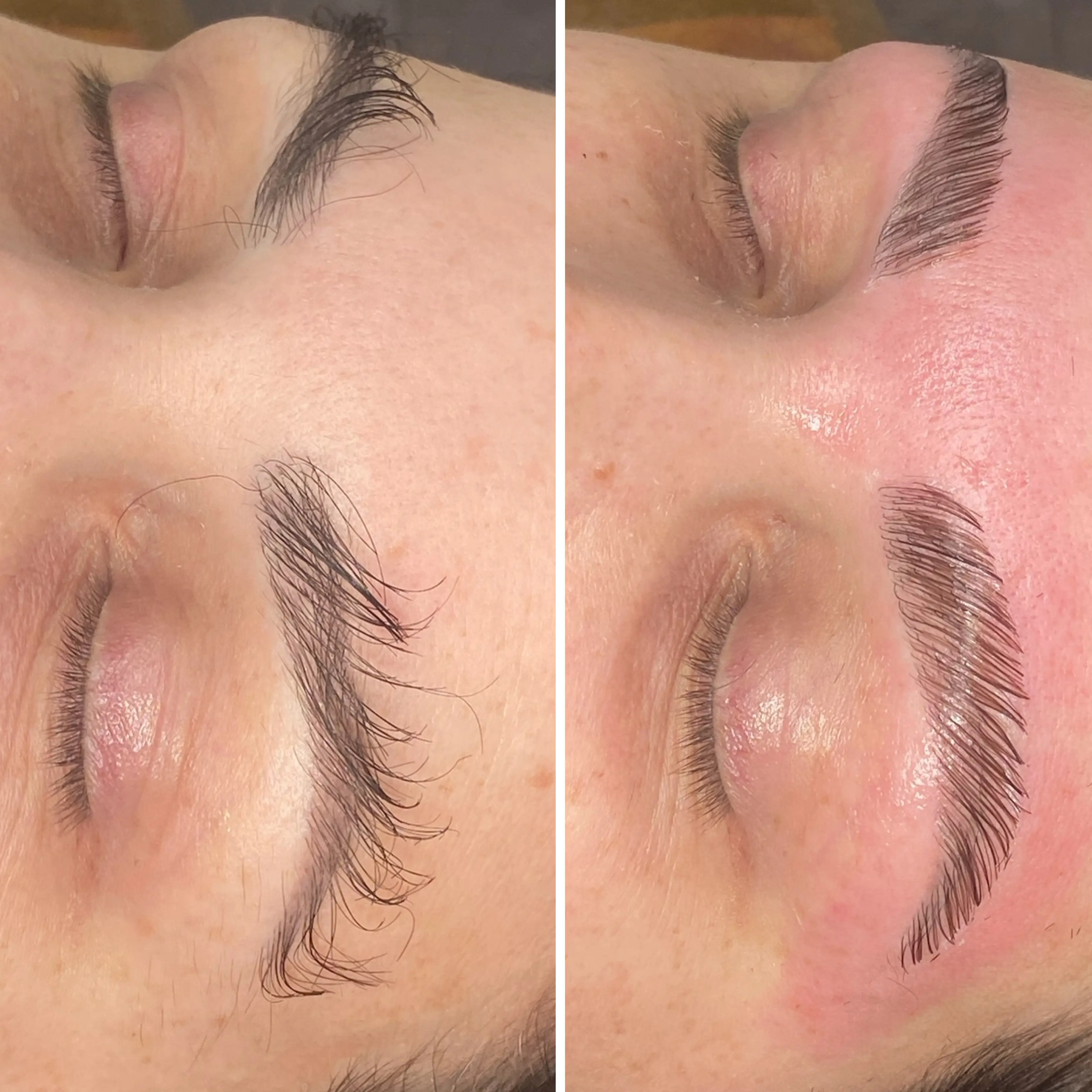 Esthetician Portfolio Photo