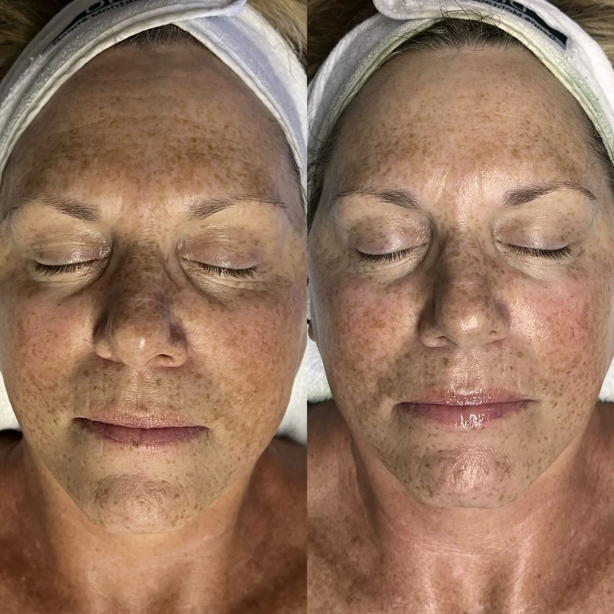 Esthetician Portfolio Photo
