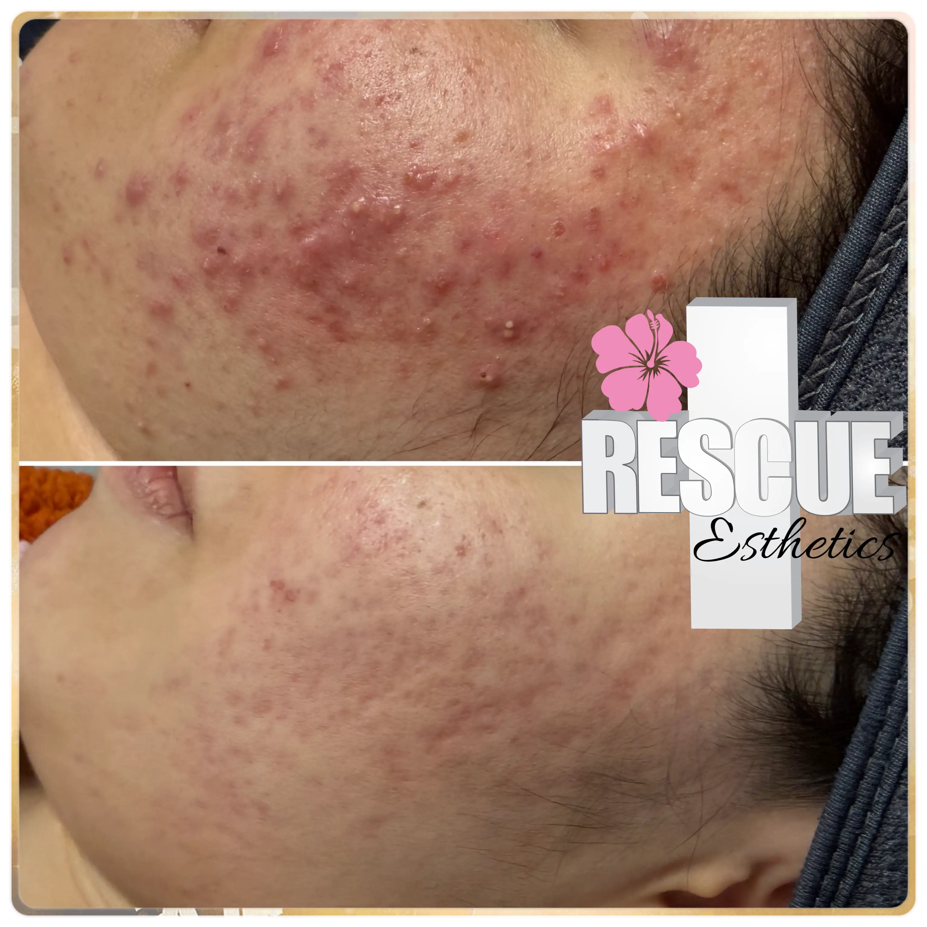 Esthetician Portfolio Photo