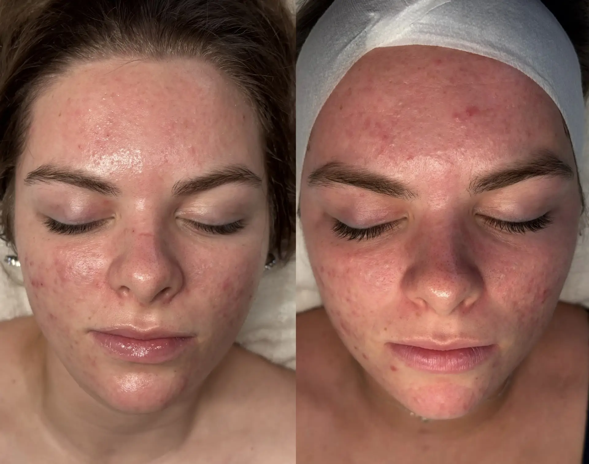 Esthetician Portfolio Photo