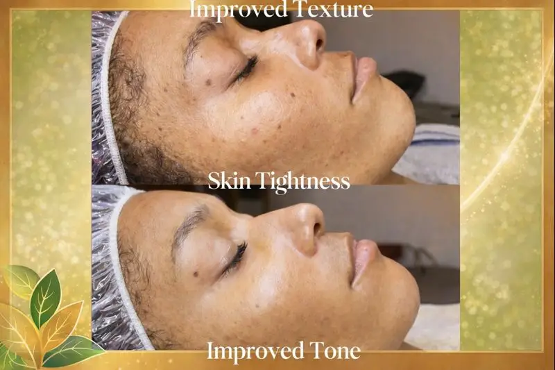 Esthetician Portfolio Photo