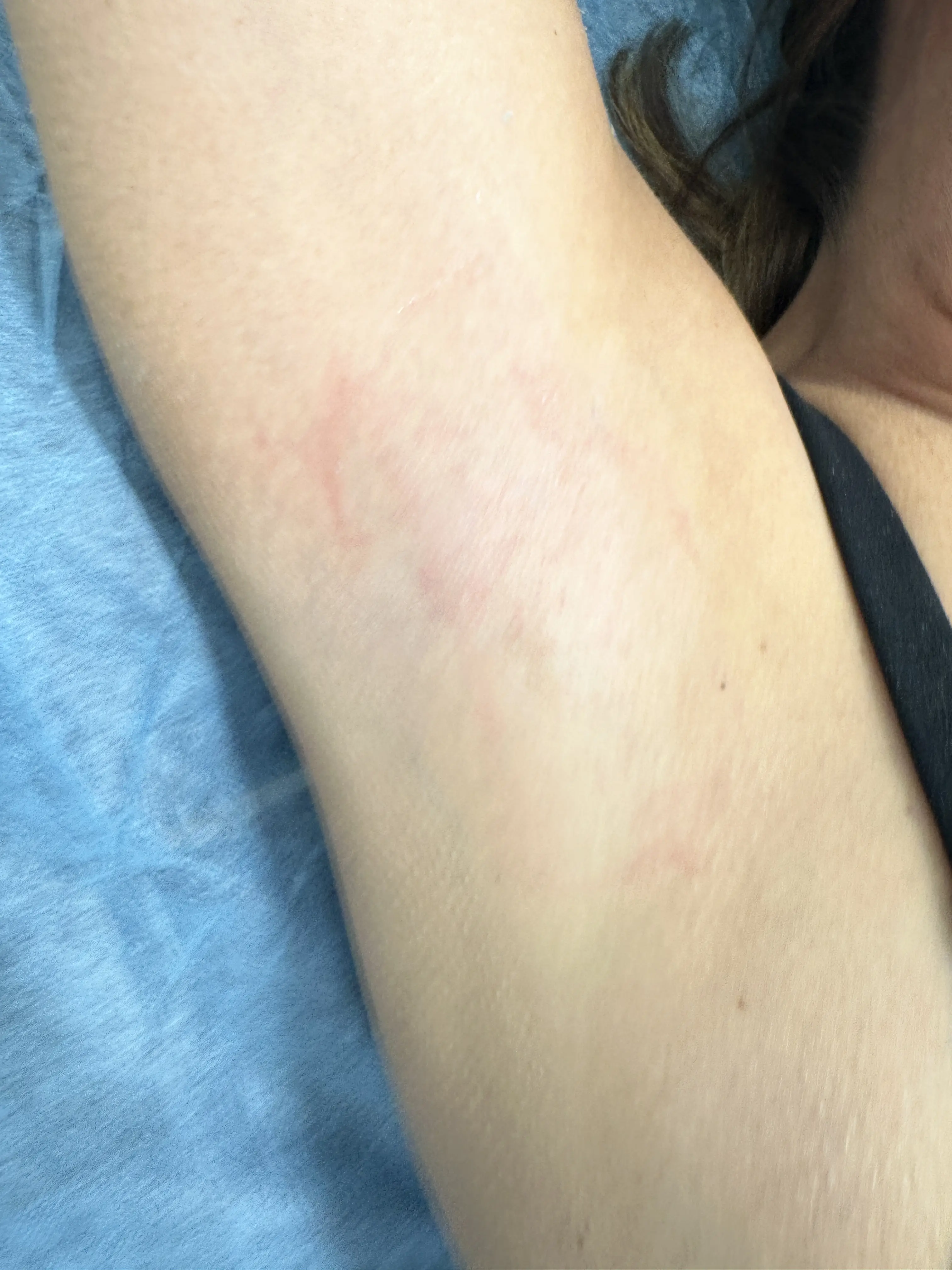 Body Waxing-Underarm