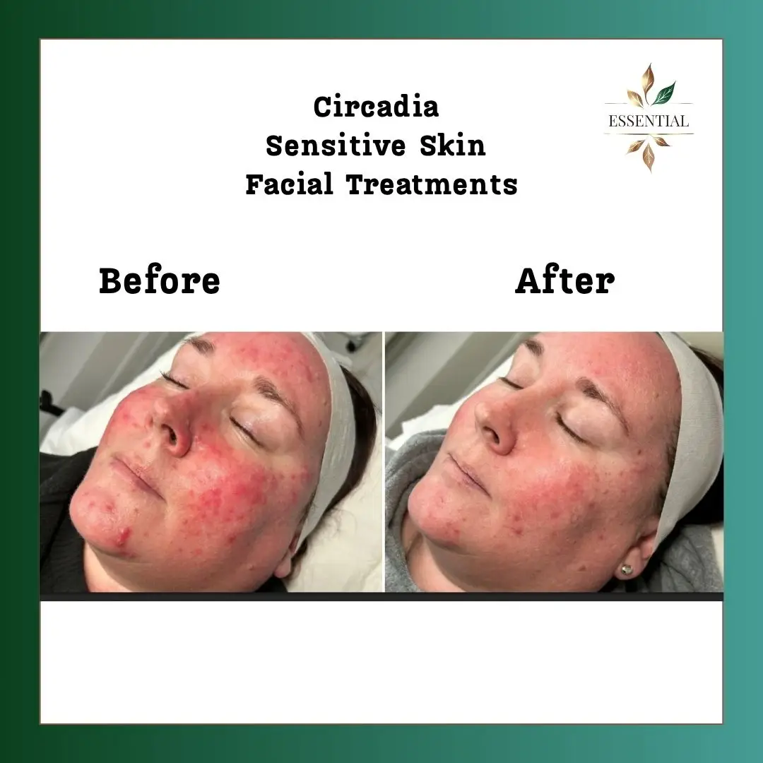 Esthetician Portfolio Photo