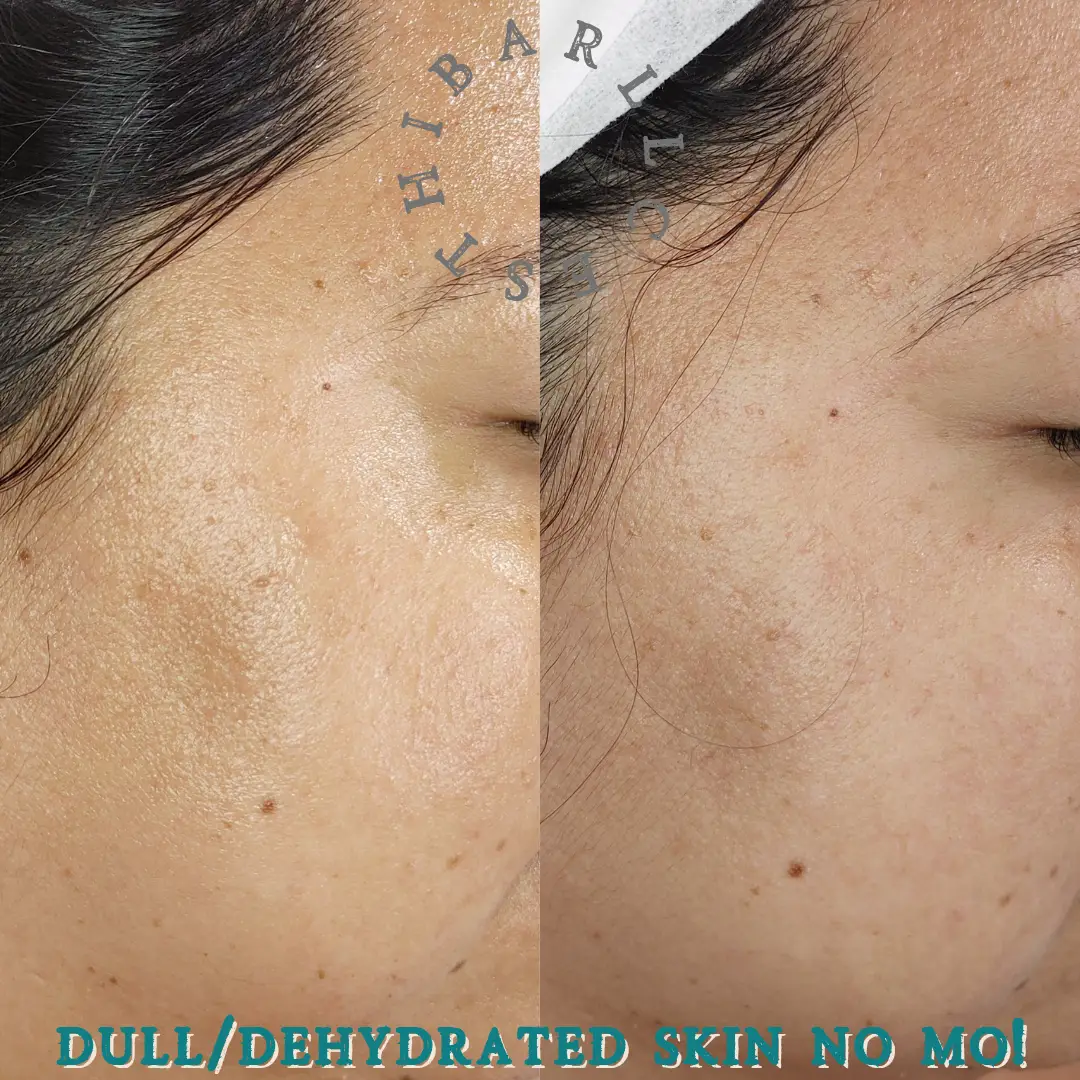 Esthetician Portfolio Photo