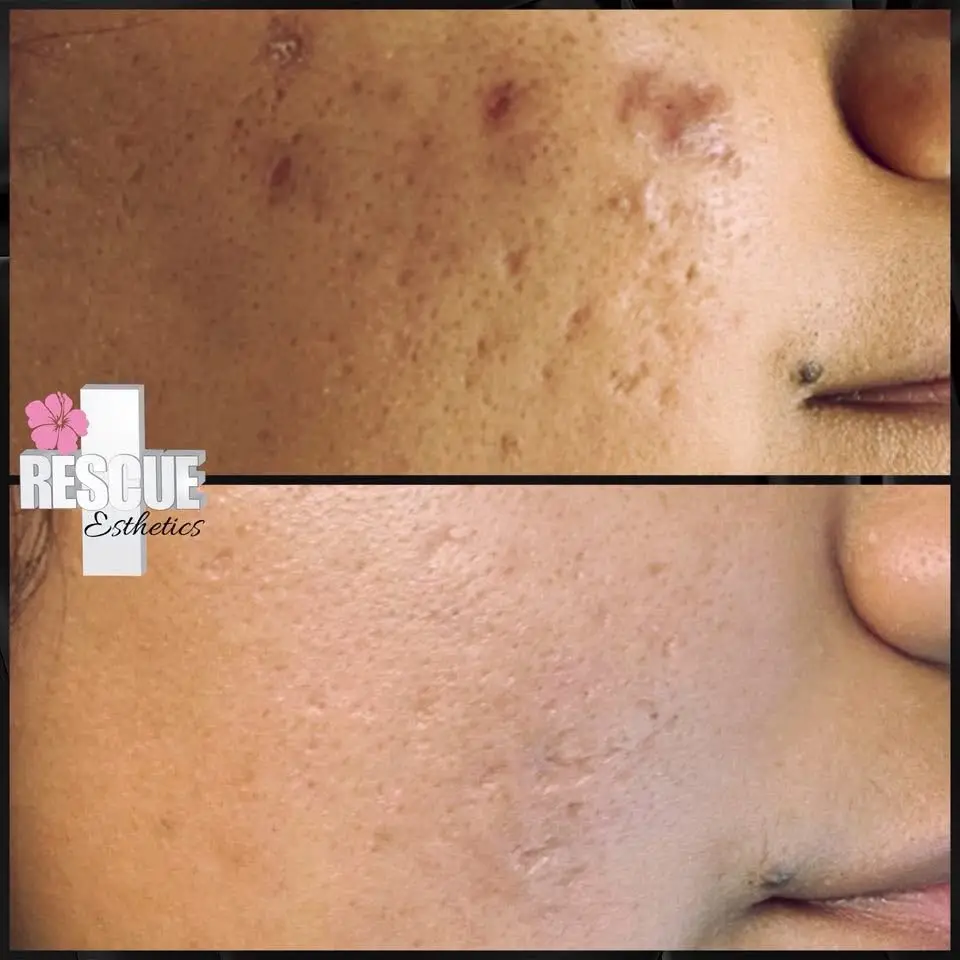 Esthetician Portfolio Photo