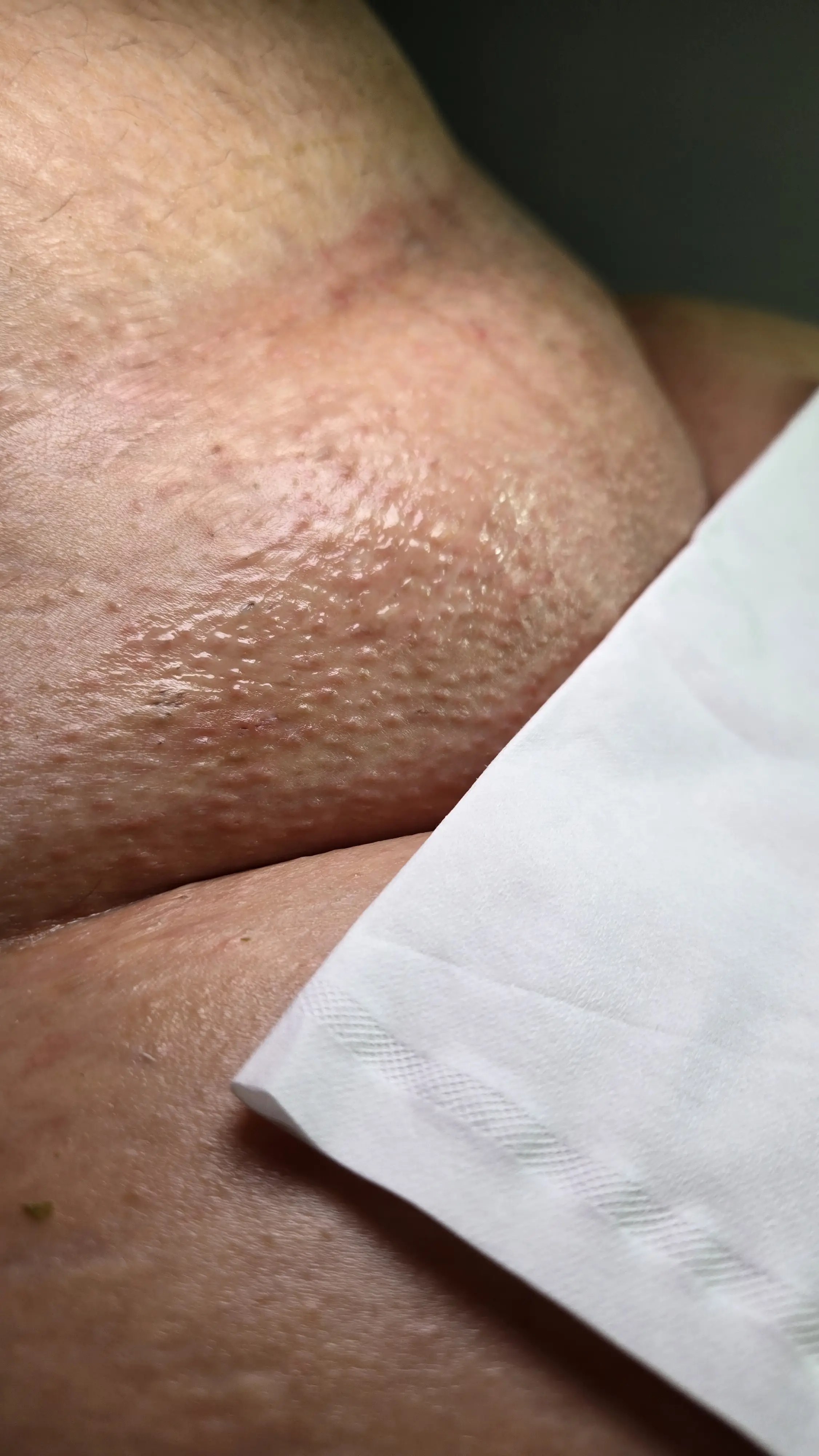 Waxing Specialist Portfolio Photo