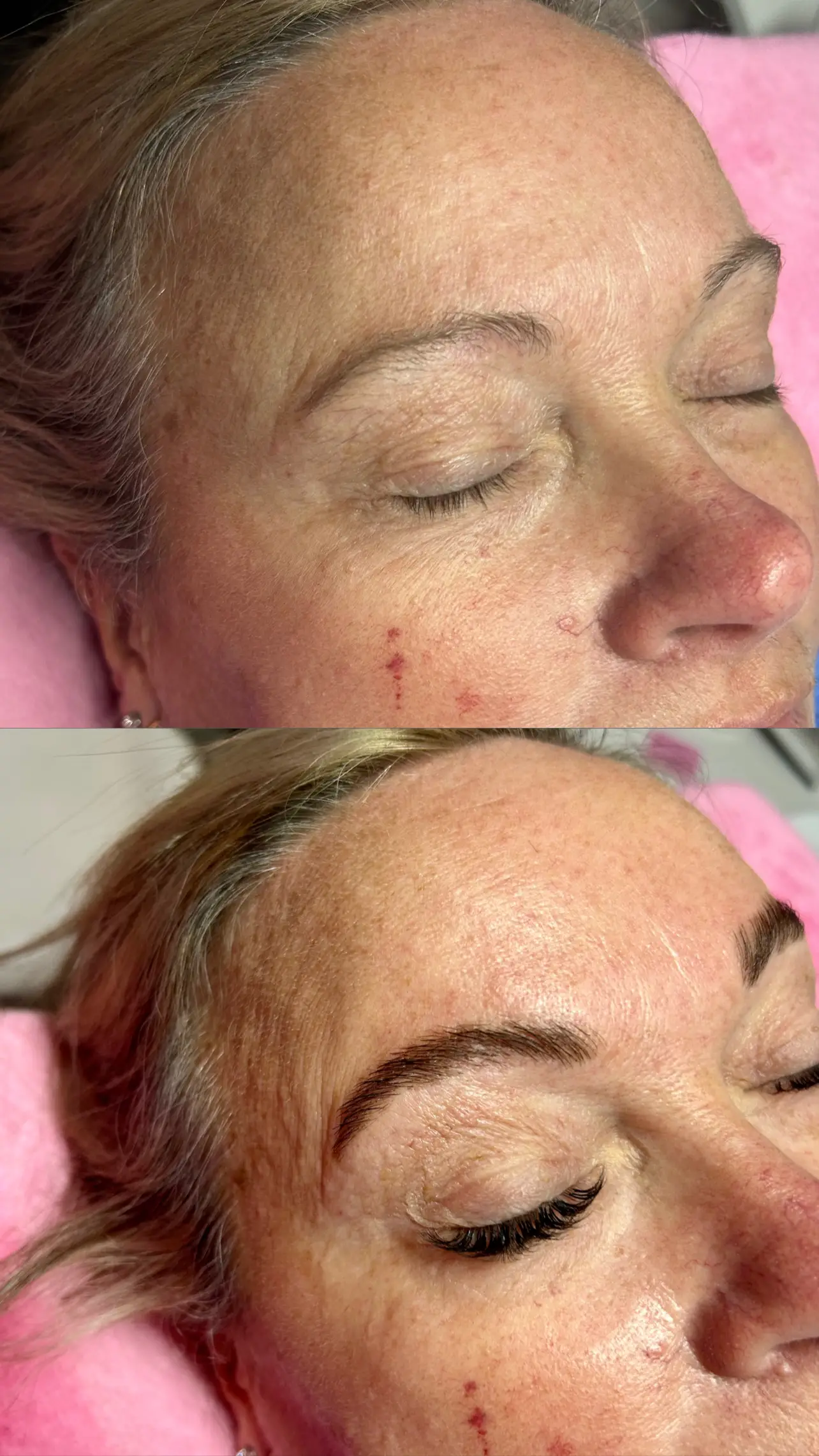 Esthetician Portfolio Photo