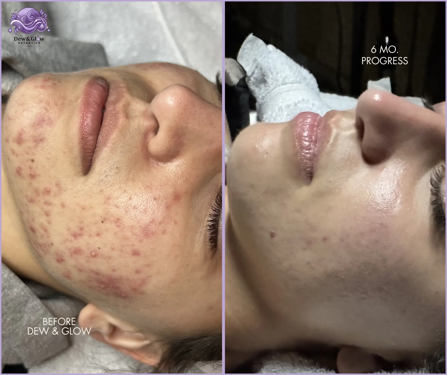 Level 1: Entry Facial