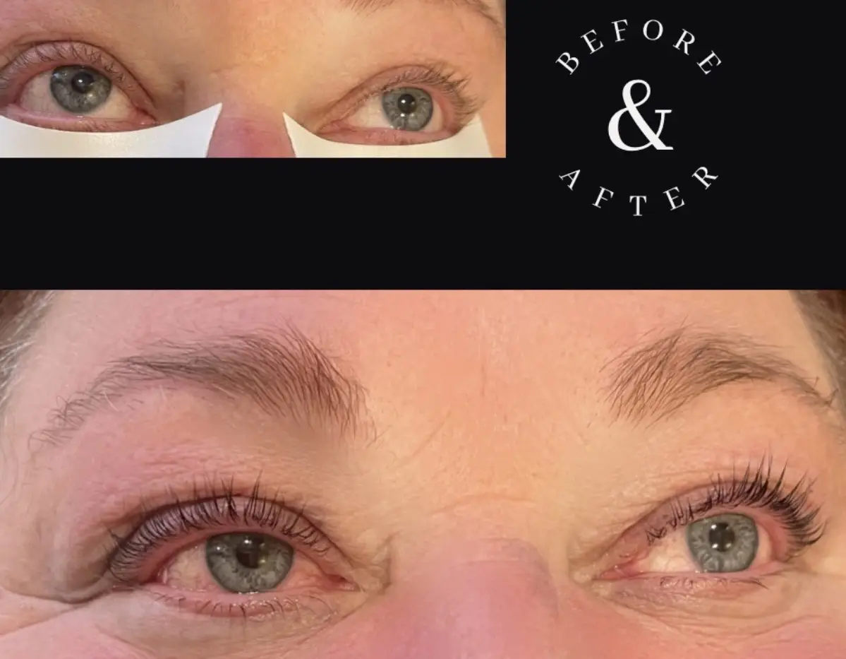 Esthetician Portfolio Photo