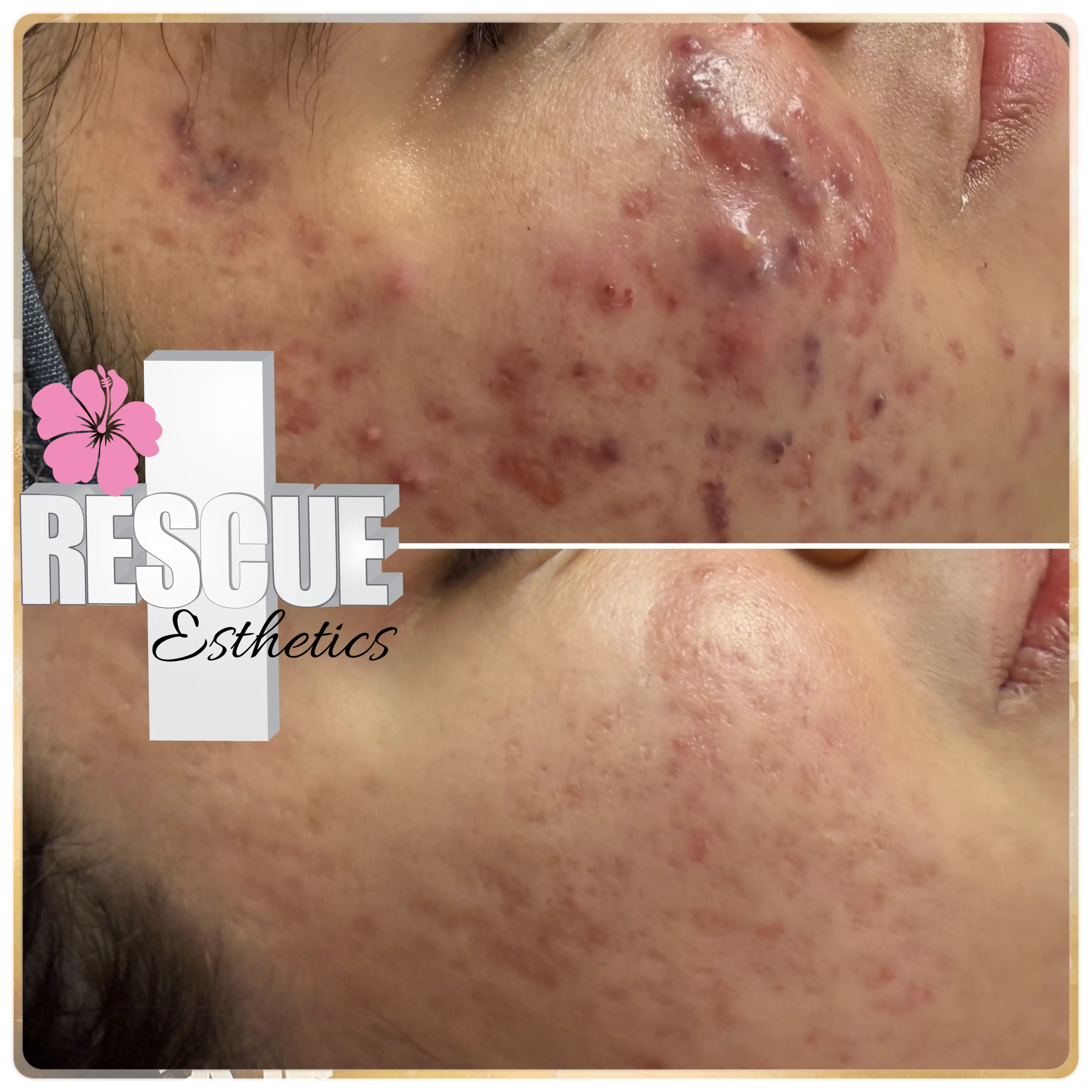 Esthetician Portfolio Photo