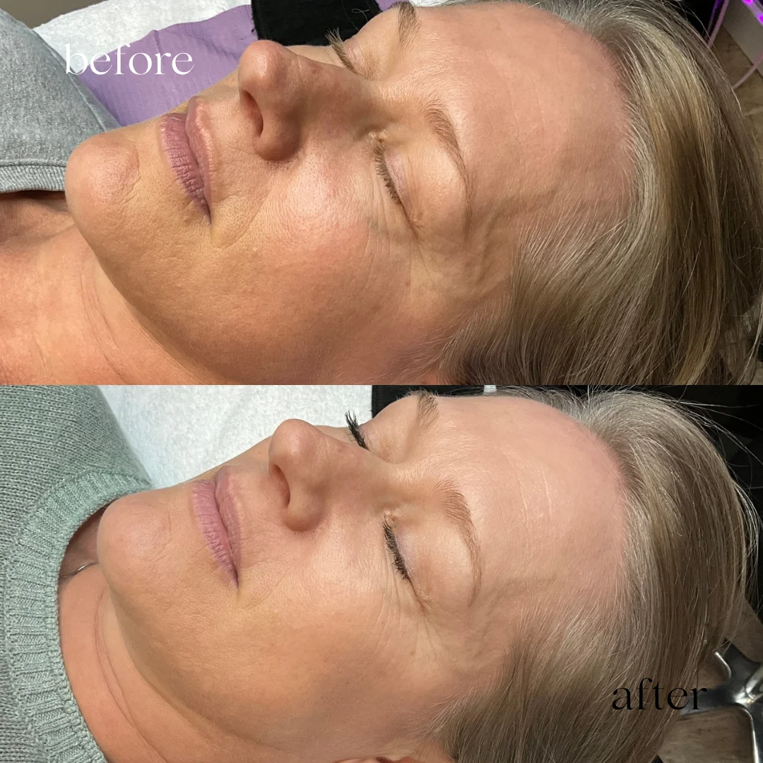 Corrective Treatments