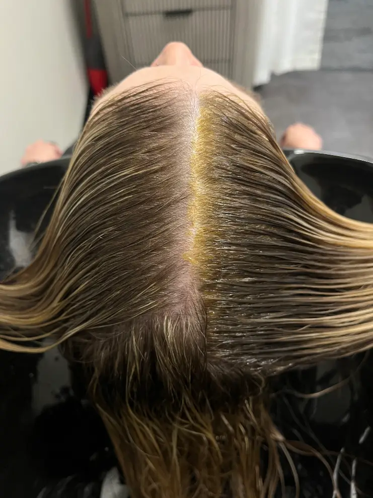 Root Retouch