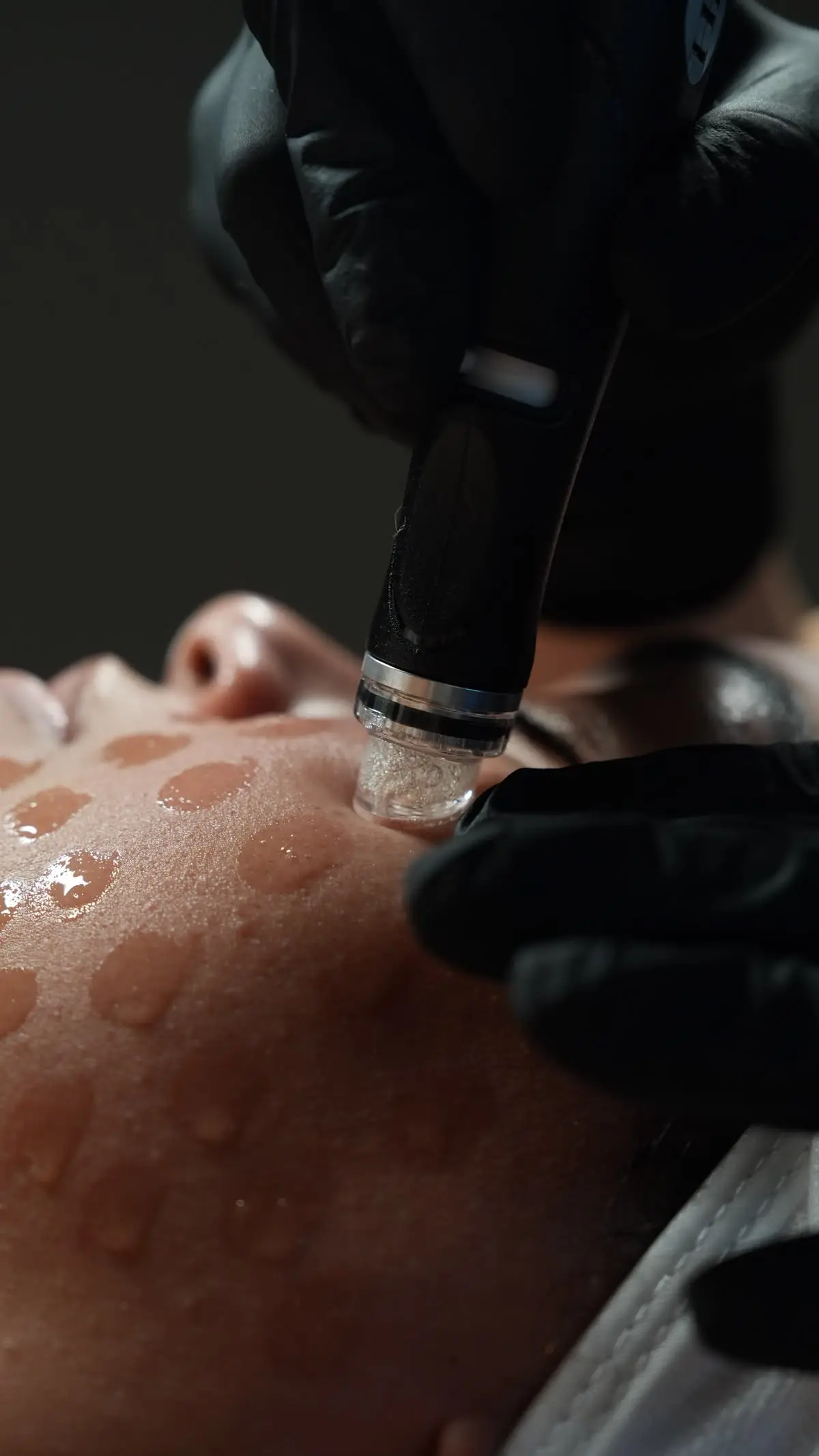 Anti-Aging Hydrafacial
