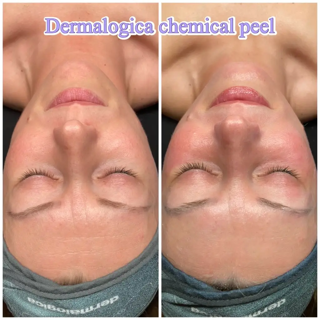 Advanced 30 Min Facial