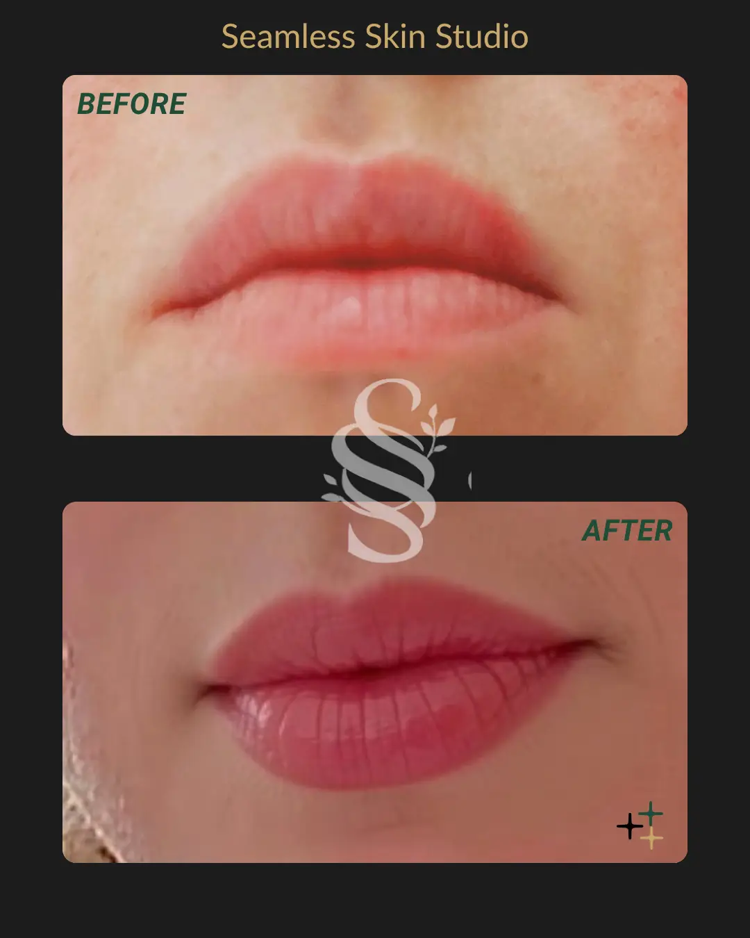 Lip Blush