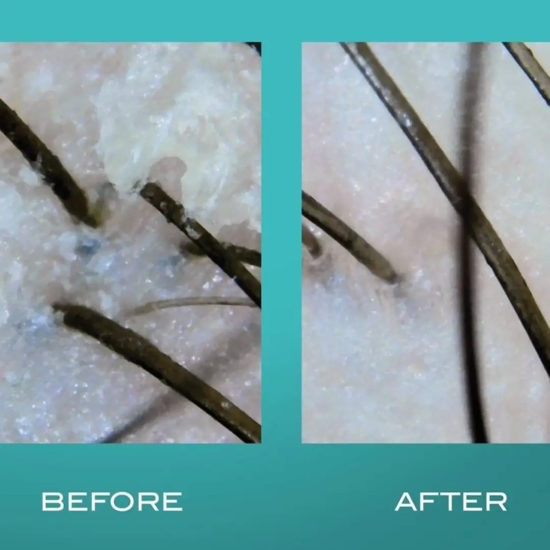 Scalp And Hair Detox Treatment