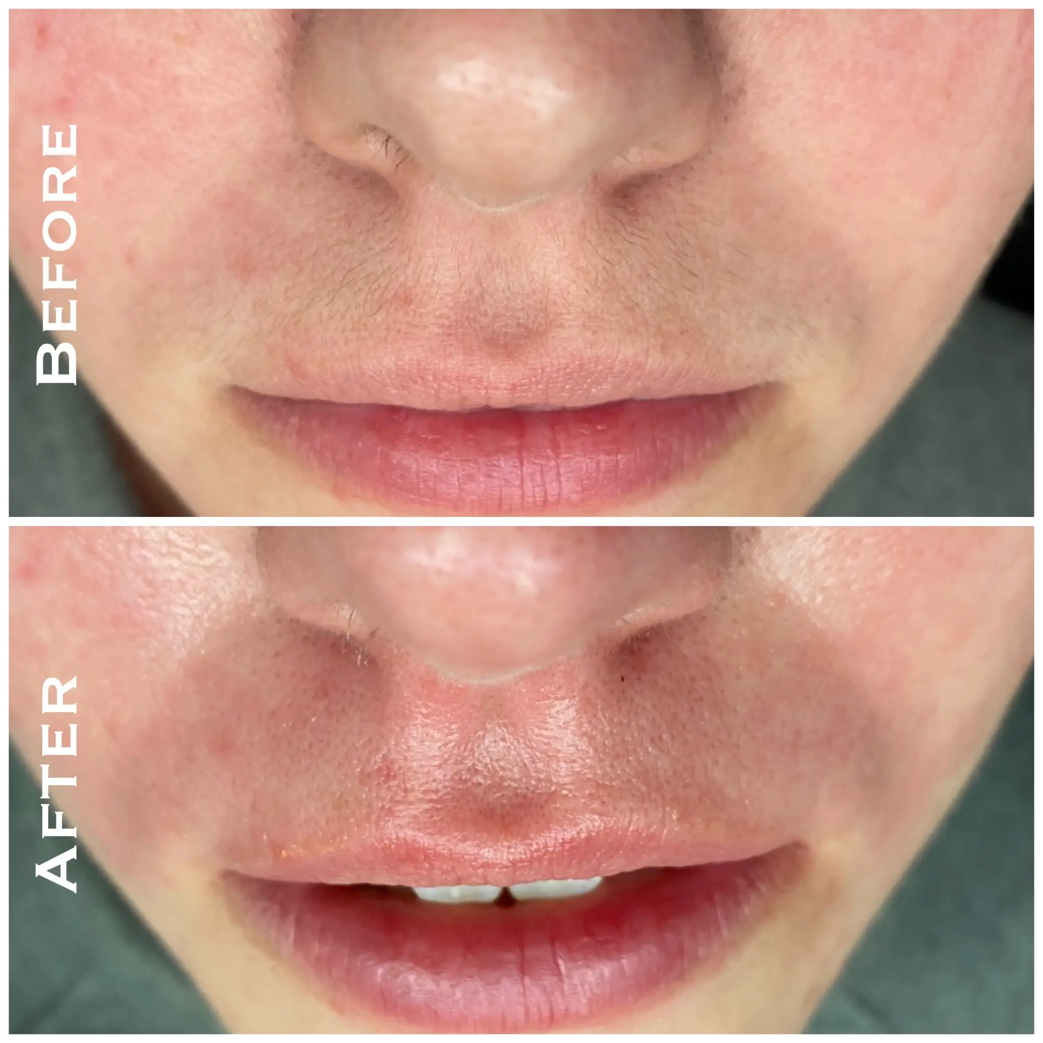 Lip Wax
