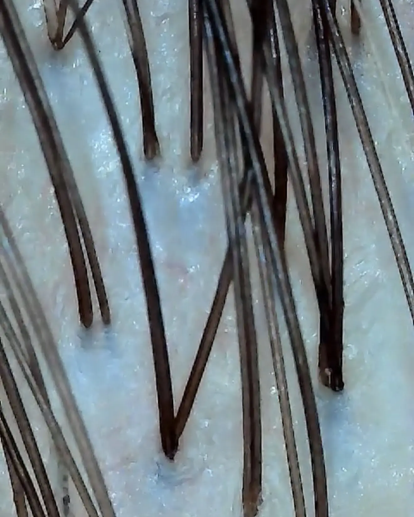 Deluxe Scalp Detox Treatment